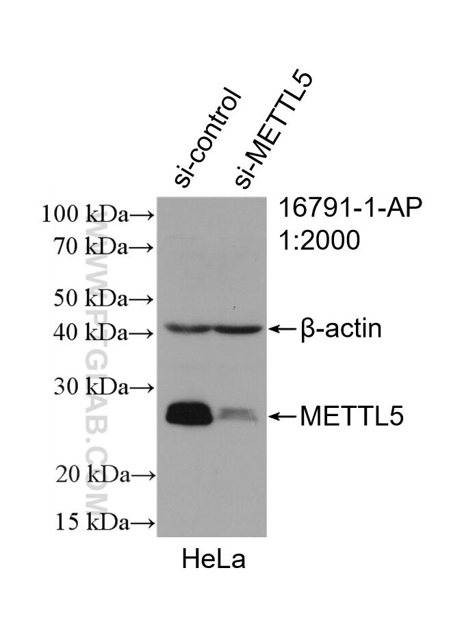 Western Blot (WB) analysis of HeLa cells using METTL5 Polyclonal antibody (16791-1-AP)