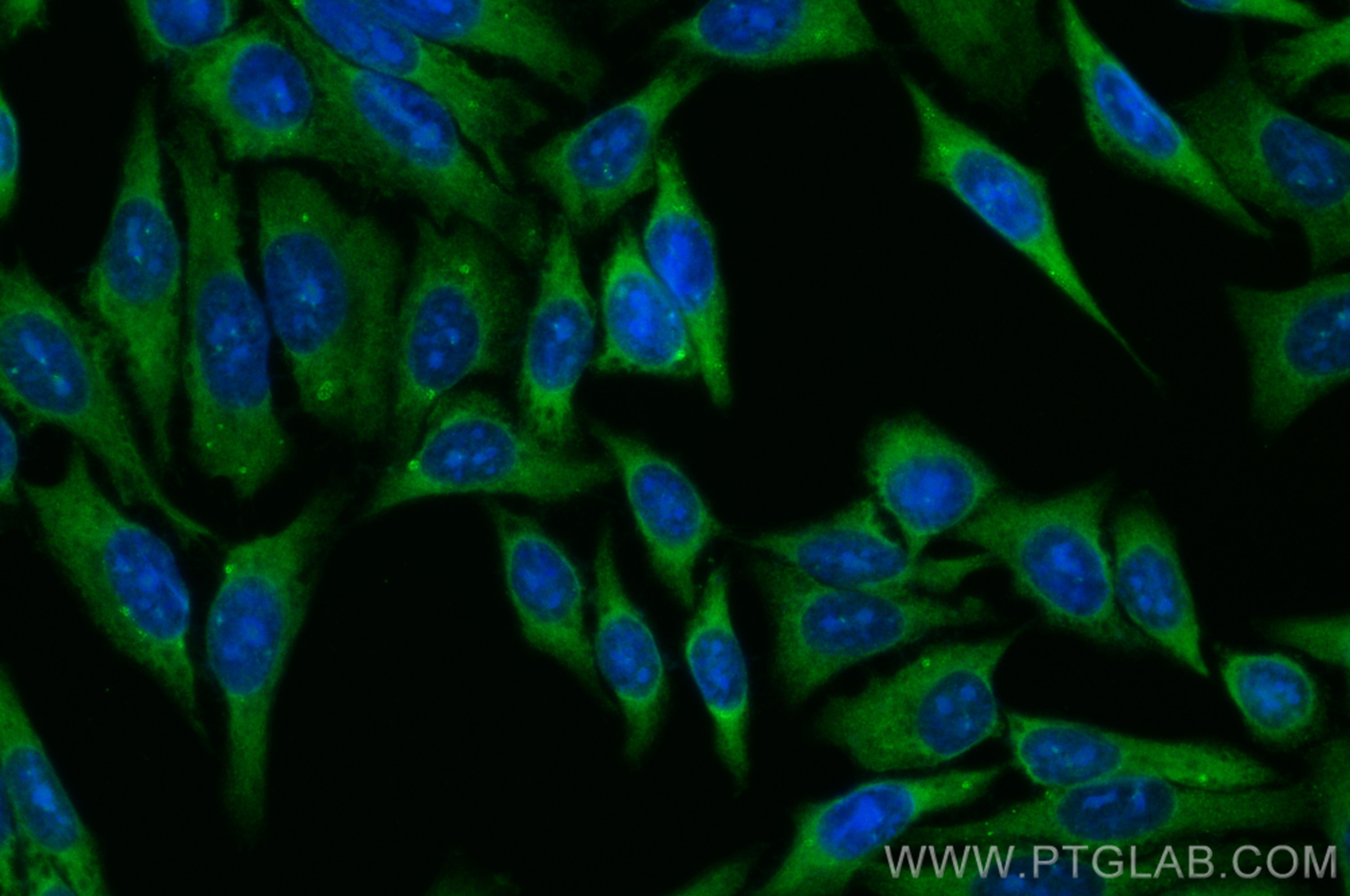 Immunofluorescence (IF) / fluorescent staining of HepG2 cells using CoraLite® Plus 488-conjugated METTL5 Polyclonal an (CL488-16791)