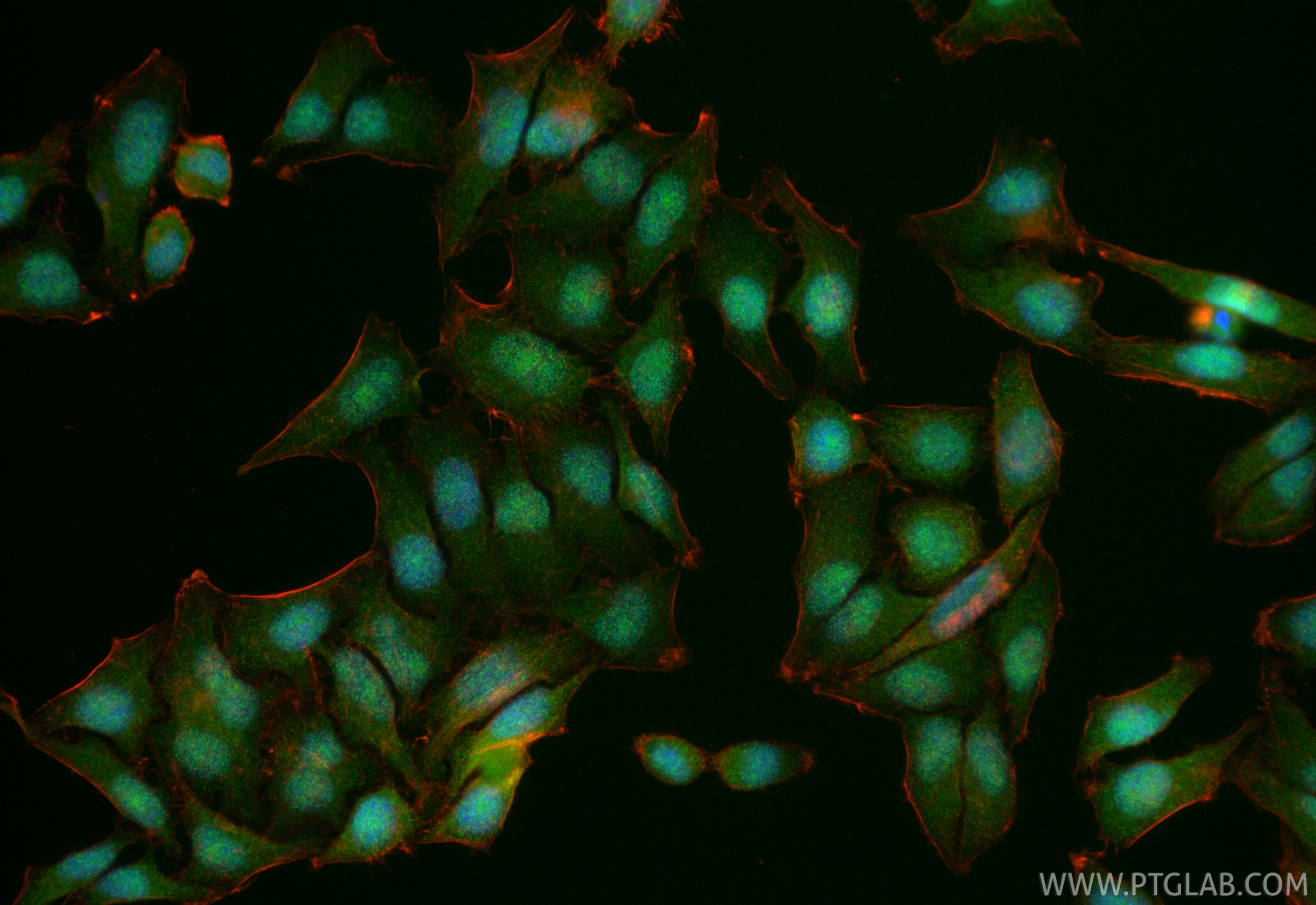 Immunofluorescence (IF) / fluorescent staining of HepG2 cells using Multi-rAb® METTL5 Multi-Recombinant antibody (RMX00070)