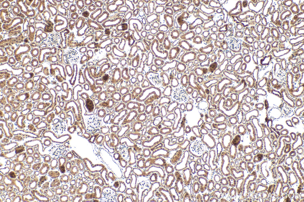 Immunohistochemistry (IHC) staining of mouse kidney tissue using Multi-rAb® METTL5 Multi-Recombinant antibody (RMX00070)