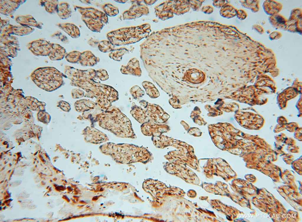 Immunohistochemistry (IHC) staining of human placenta tissue using METTL6 Polyclonal antibody (16527-1-AP)