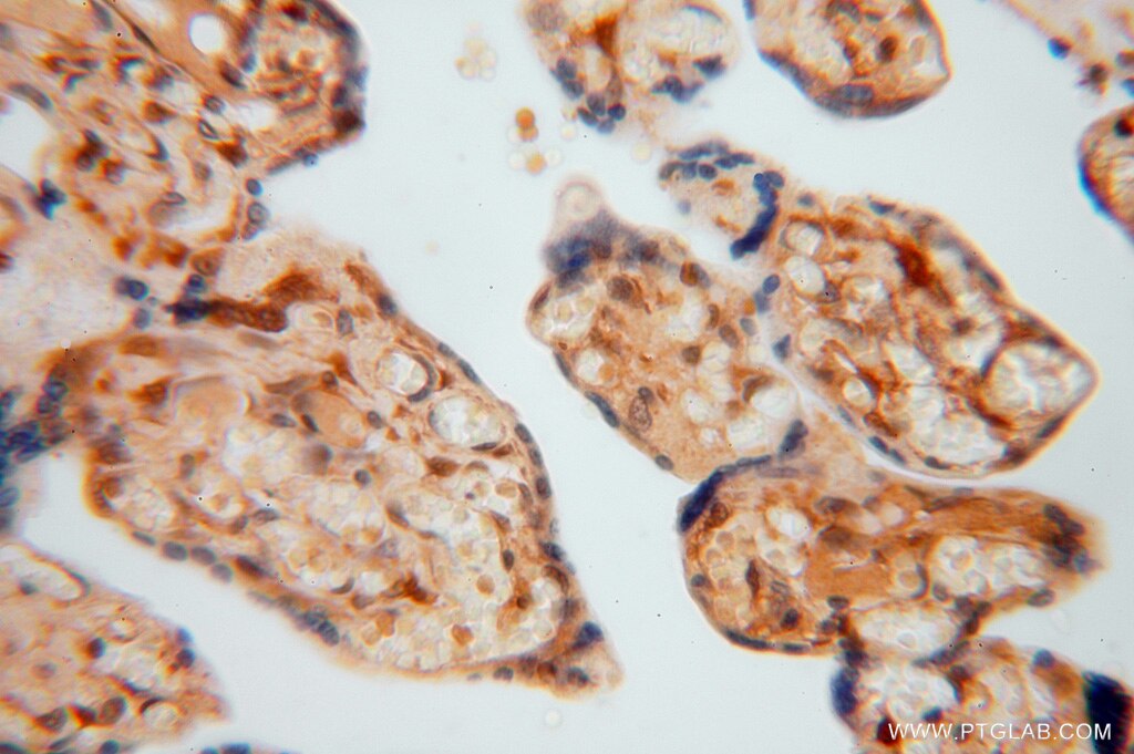 Immunohistochemistry (IHC) staining of human placenta tissue using METTL6 Polyclonal antibody (16527-1-AP)