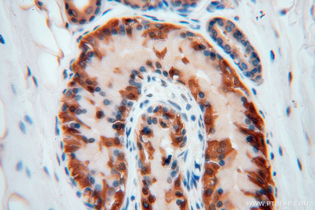 IHC staining of human skin using 16527-1-AP