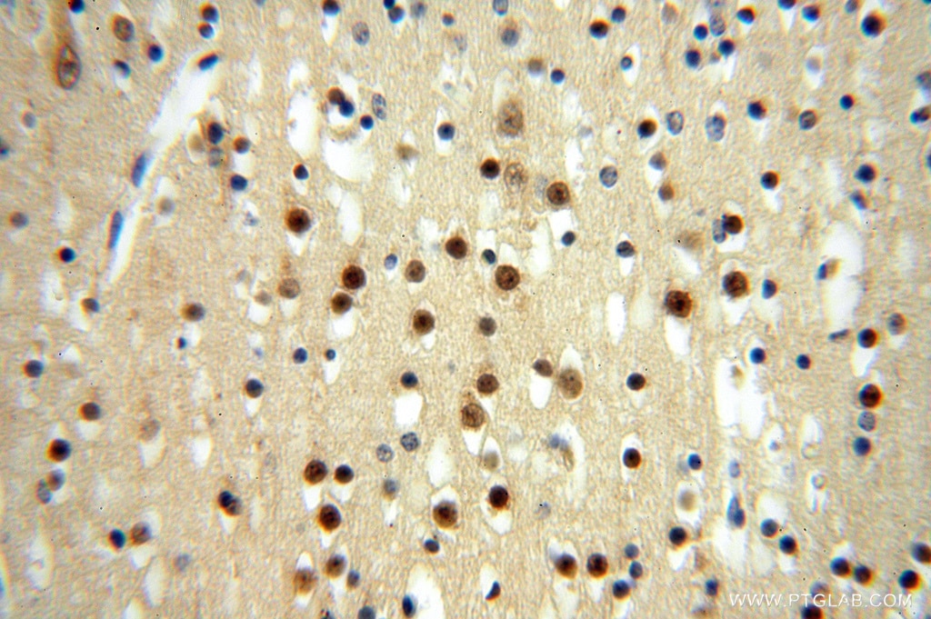 Immunohistochemistry (IHC) staining of human brain tissue using METTL6 Polyclonal antibody (16527-1-AP)