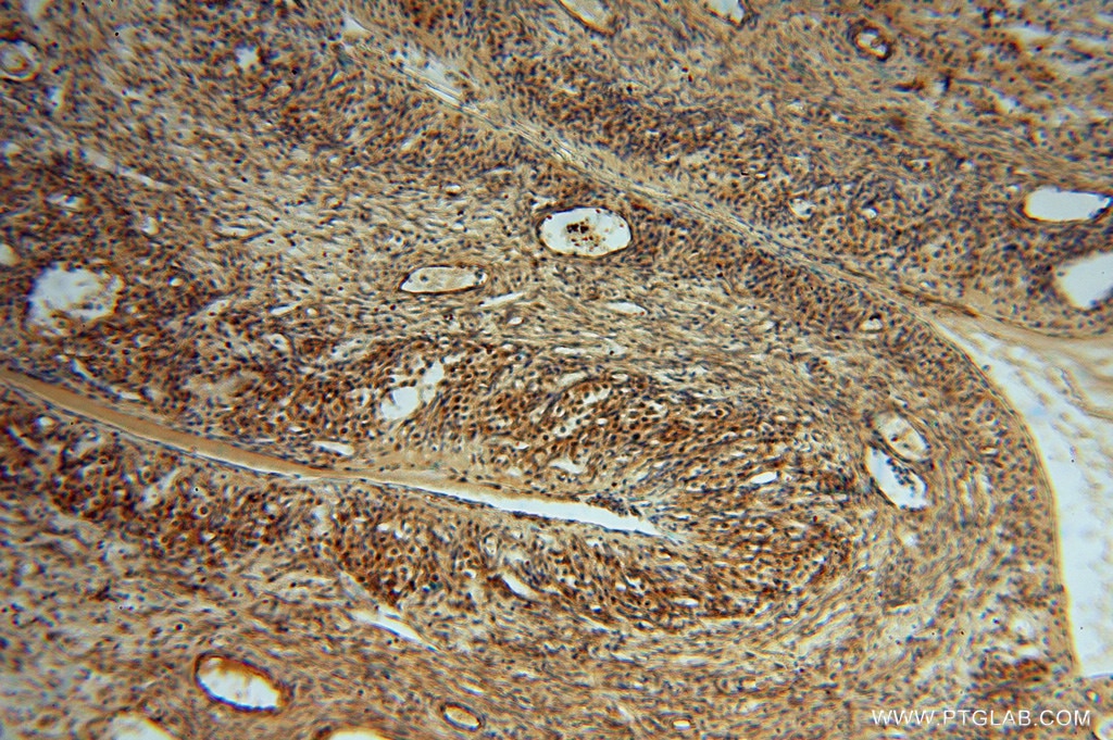 Immunohistochemistry (IHC) staining of human ovary tissue using METTL6 Polyclonal antibody (16527-1-AP)