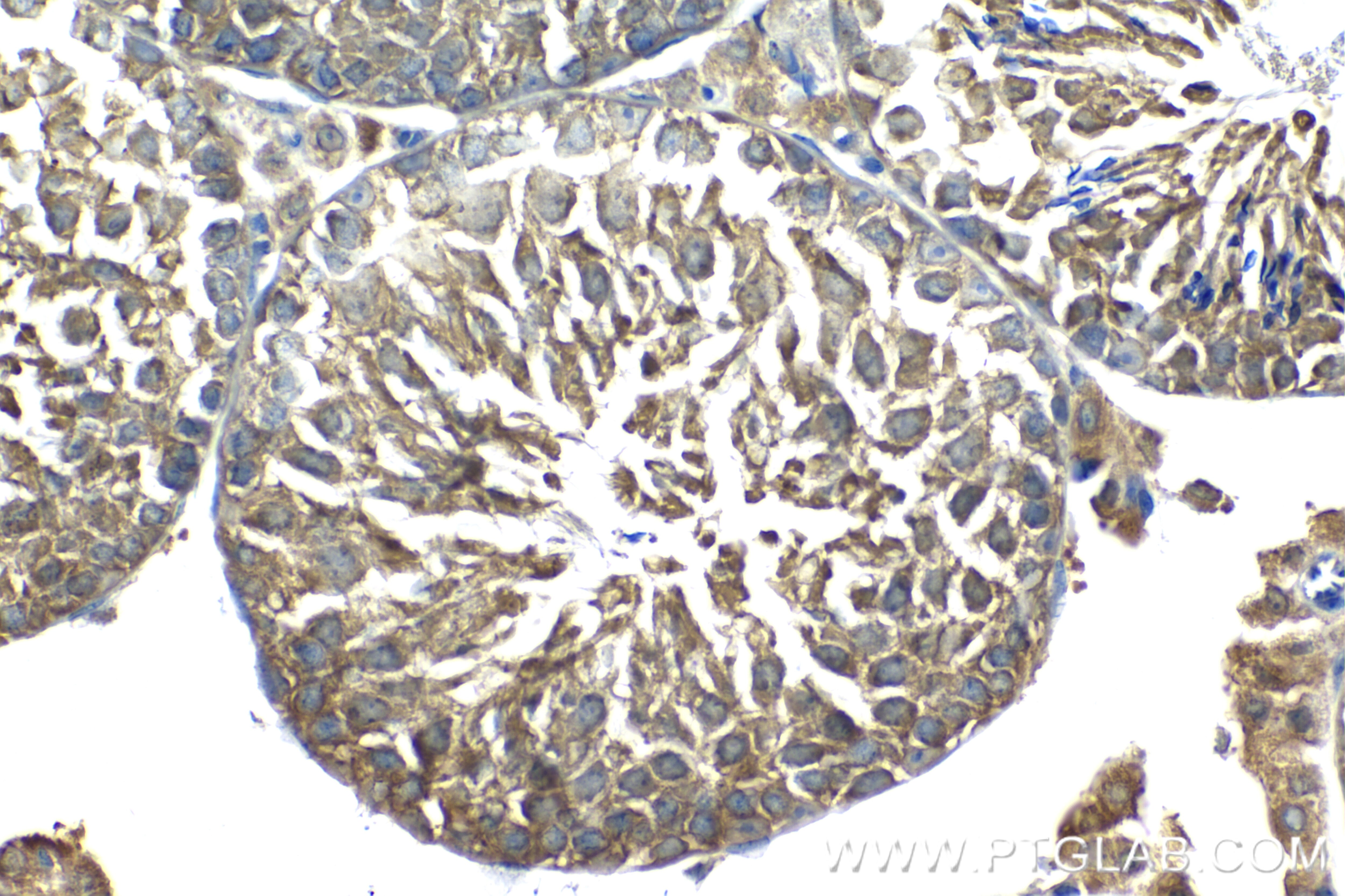 Immunohistochemistry (IHC) staining of mouse testis tissue using METTL6 Recombinant antibody (84209-5-RR)