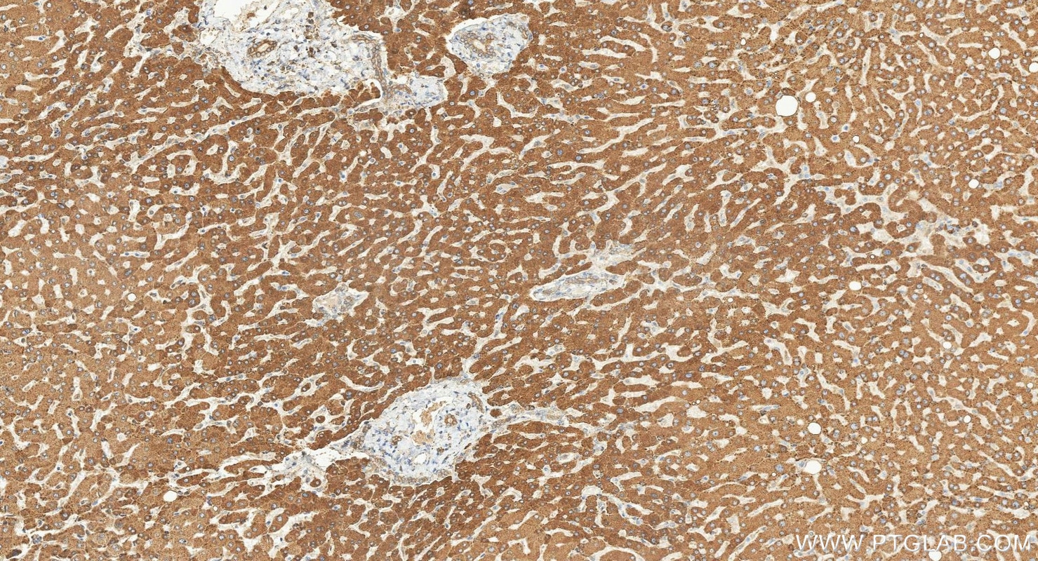 Immunohistochemistry (IHC) staining of human liver tissue using METTL7A Polyclonal antibody (17092-1-AP)