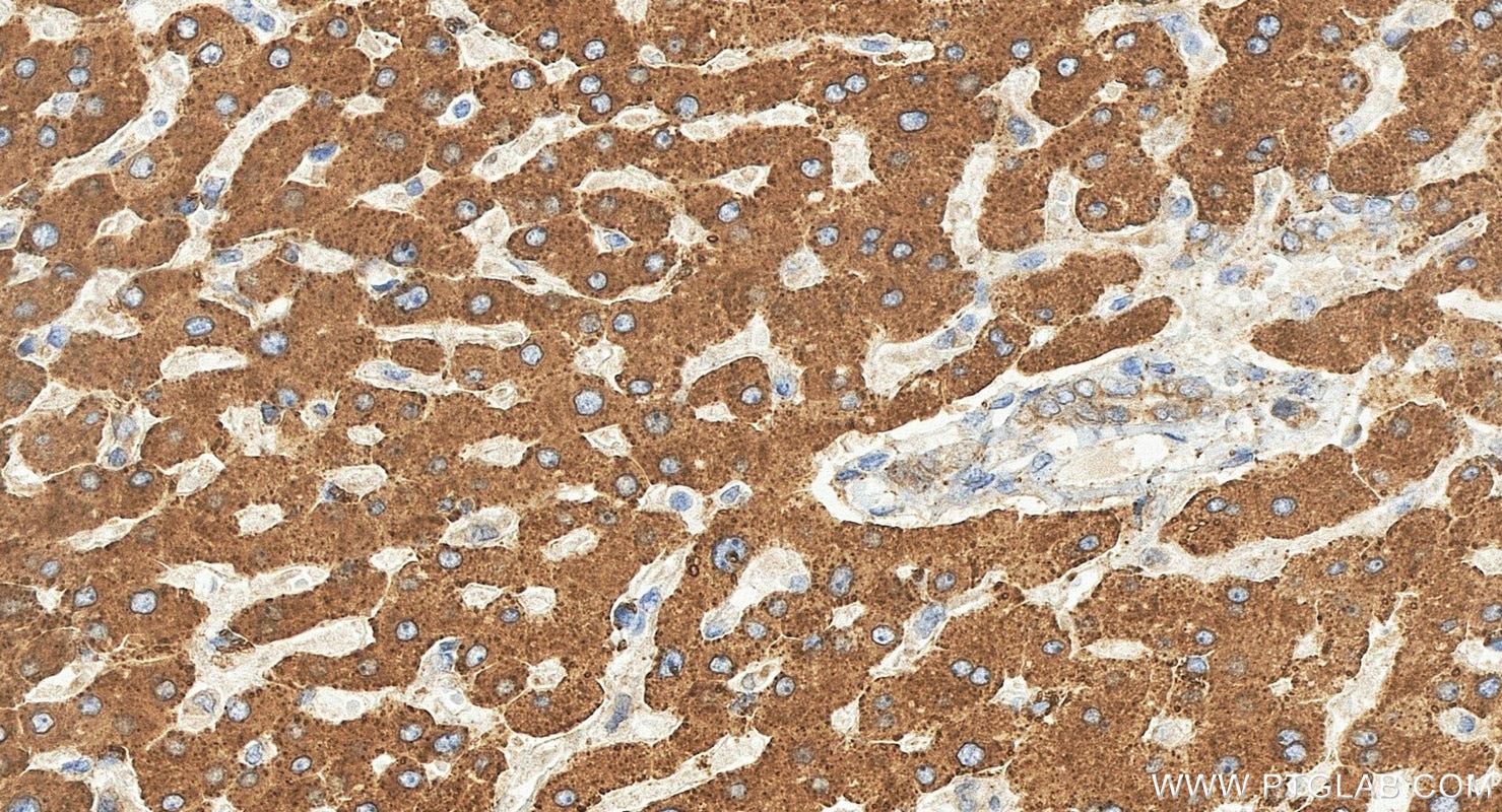 Immunohistochemistry (IHC) staining of human liver tissue using METTL7A Polyclonal antibody (17092-1-AP)
