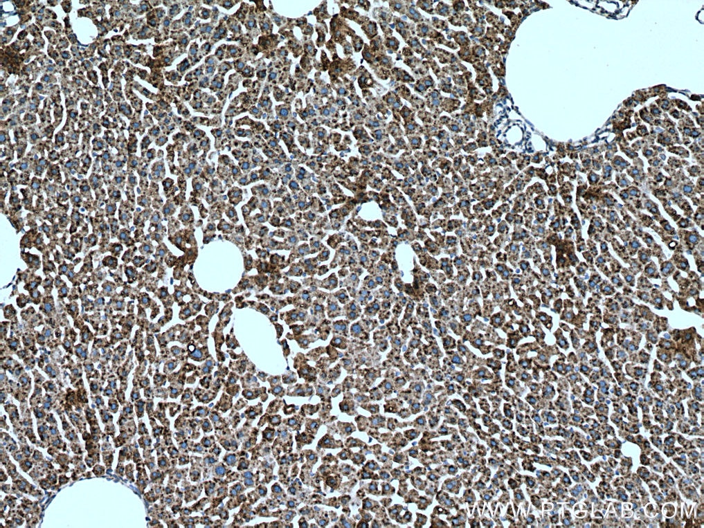 Immunohistochemistry (IHC) staining of mouse liver tissue using METTL7B Polyclonal antibody (17001-1-AP)