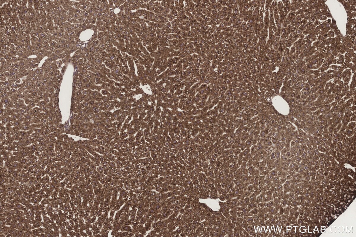 Immunohistochemistry (IHC) staining of mouse liver tissue using METTL7B Polyclonal antibody (17001-1-AP)
