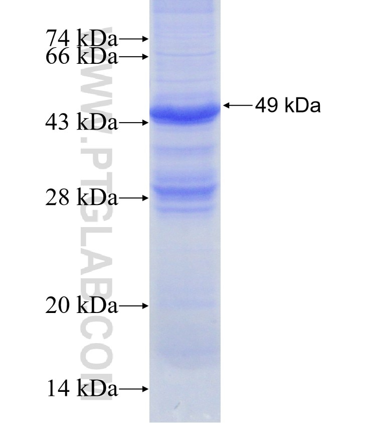 METTL7B fusion protein Ag10694 SDS-PAGE