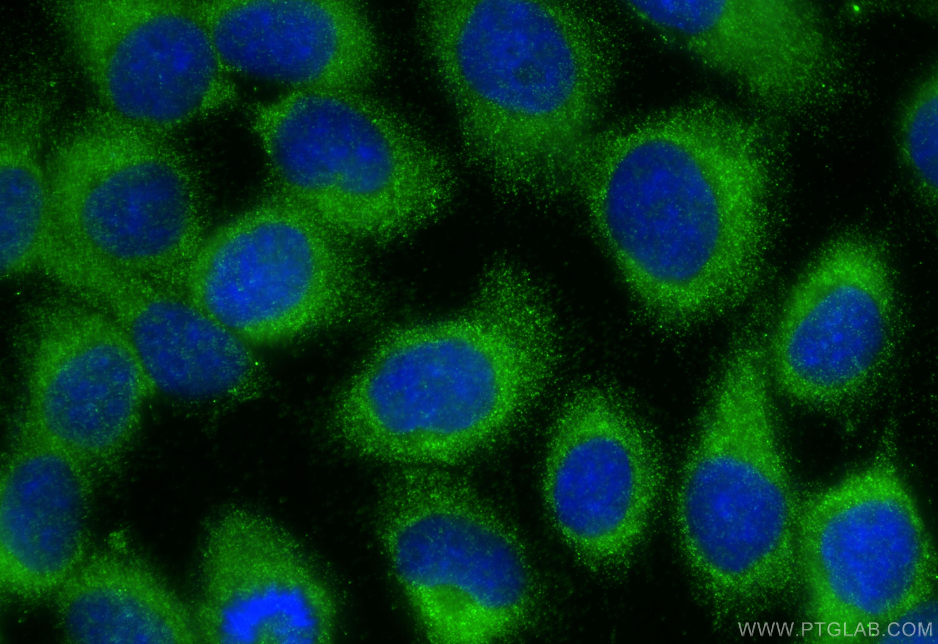 Immunofluorescence (IF) / fluorescent staining of A431 cells using METTL8 Polyclonal antibody (31173-1-AP)