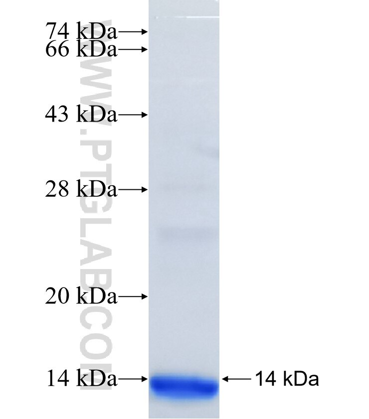 METTL8 fusion protein Ag36748 SDS-PAGE METTL8 fusion protein Ag36748 SDS-PAGE
