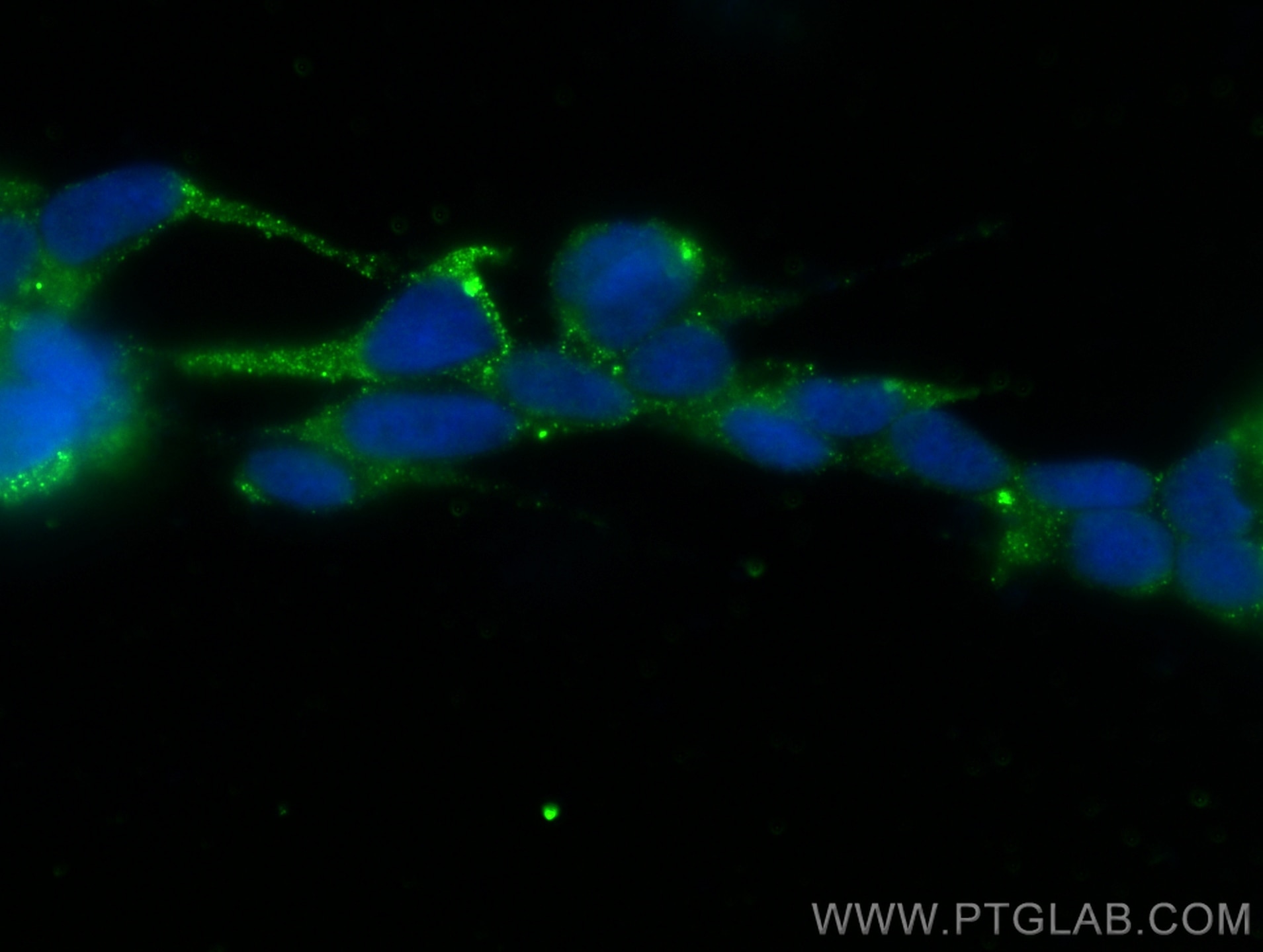 Immunofluorescence (IF) / fluorescent staining of SH-SY5Y cells using MEX3A Polyclonal antibody (30865-1-AP)