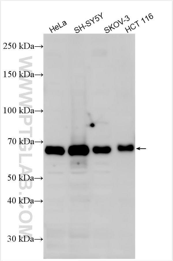 Western Blot (WB) analysis of various lysates using MEX3A Polyclonal antibody (30865-1-AP)