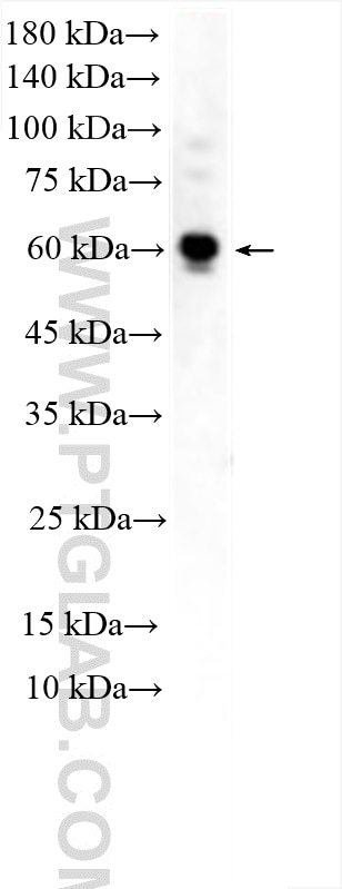 Western Blot (WB) analysis of C2C12 cells using MEX3B Polyclonal antibody (30185-1-AP)