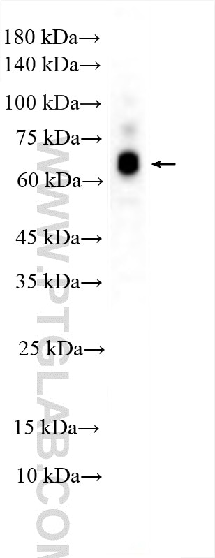 MEX3B