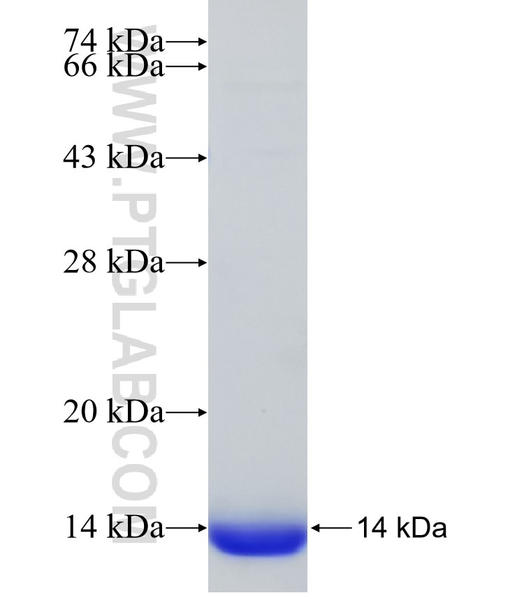 MEX3B fusion protein Ag30738 SDS-PAGE MEX3B fusion protein Ag30738 SDS-PAGE