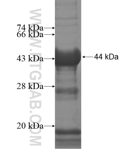 MEX3B fusion protein Ag12156 SDS-PAGE