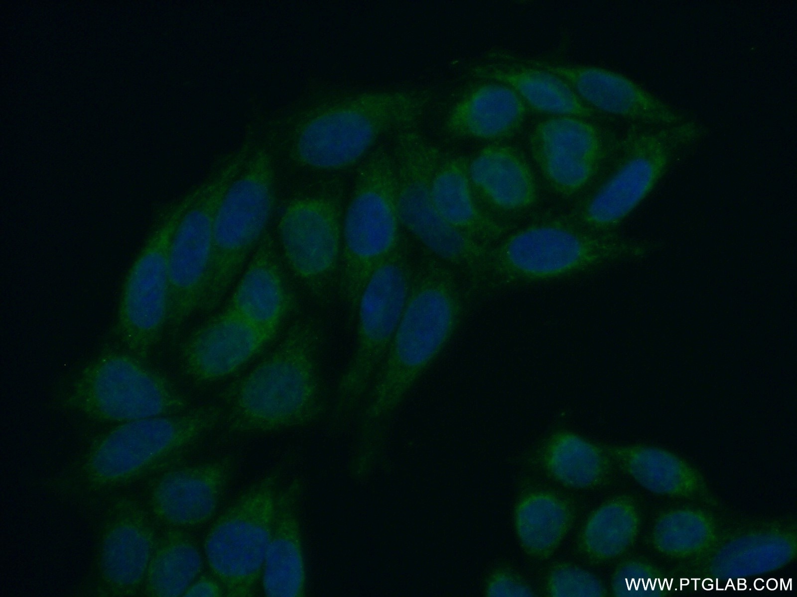 Immunofluorescence (IF) / fluorescent staining of HeLa cells using MEX3C Polyclonal antibody (22882-1-AP)