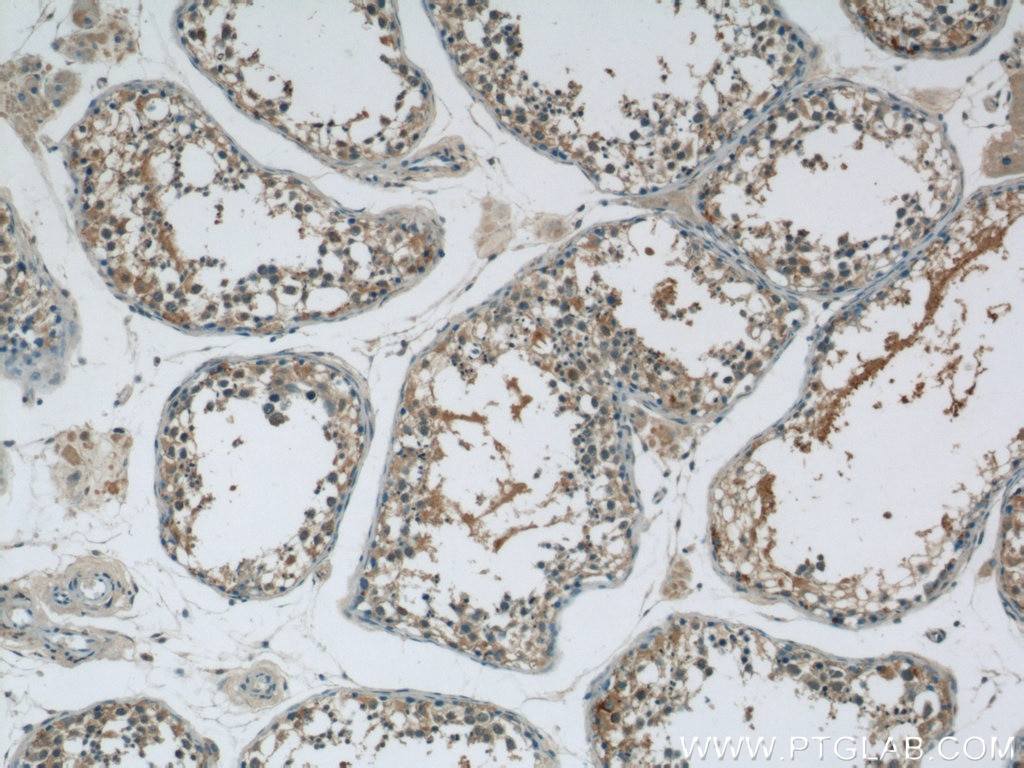 Immunohistochemistry (IHC) staining of human testis tissue using MEX3C Polyclonal antibody (22882-1-AP)
