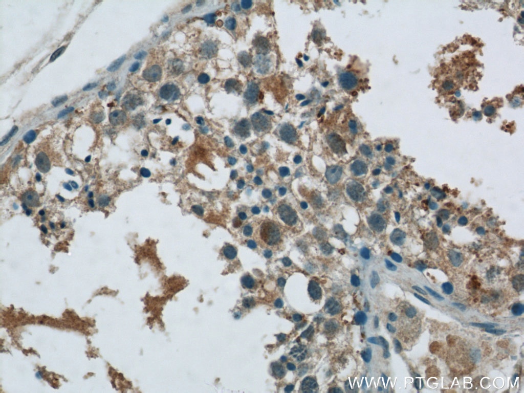 Immunohistochemistry (IHC) staining of human testis tissue using MEX3C Polyclonal antibody (22882-1-AP)