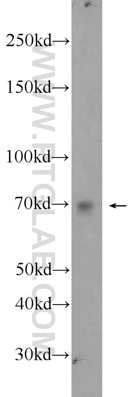 Western Blot (WB) analysis of PC-3 cells using MEX3C Polyclonal antibody (22882-1-AP)