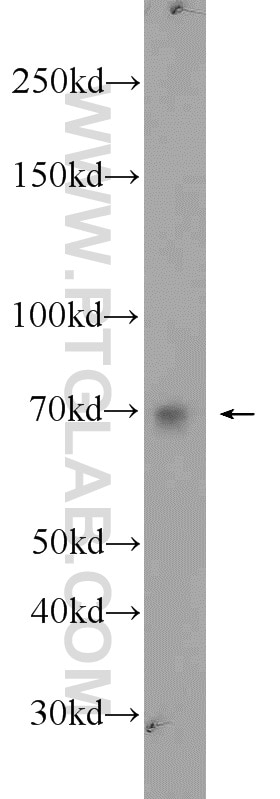 Western Blot (WB) analysis of PC-3 cells using MEX3C Polyclonal antibody (22882-1-AP)