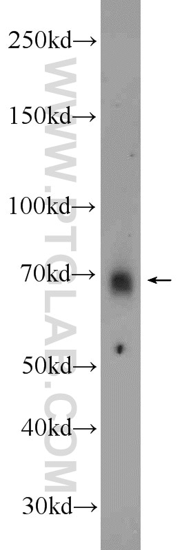Western Blot (WB) analysis of HeLa cells using MEX3C Polyclonal antibody (22882-1-AP)