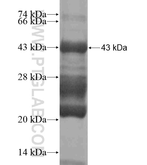 MEX3C fusion protein Ag18931 SDS-PAGE