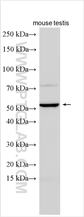 Various lysates were subjected to SDS PAGE followed by western blot with 33188-1-AP (MFAP3L antibody) at dilution of 1:1500 incubated at room temperature for 1.5 hours. Western Blot (WB) analysis of various lysates using MFAP3L Polyclonal antibody (33188-1-AP)
