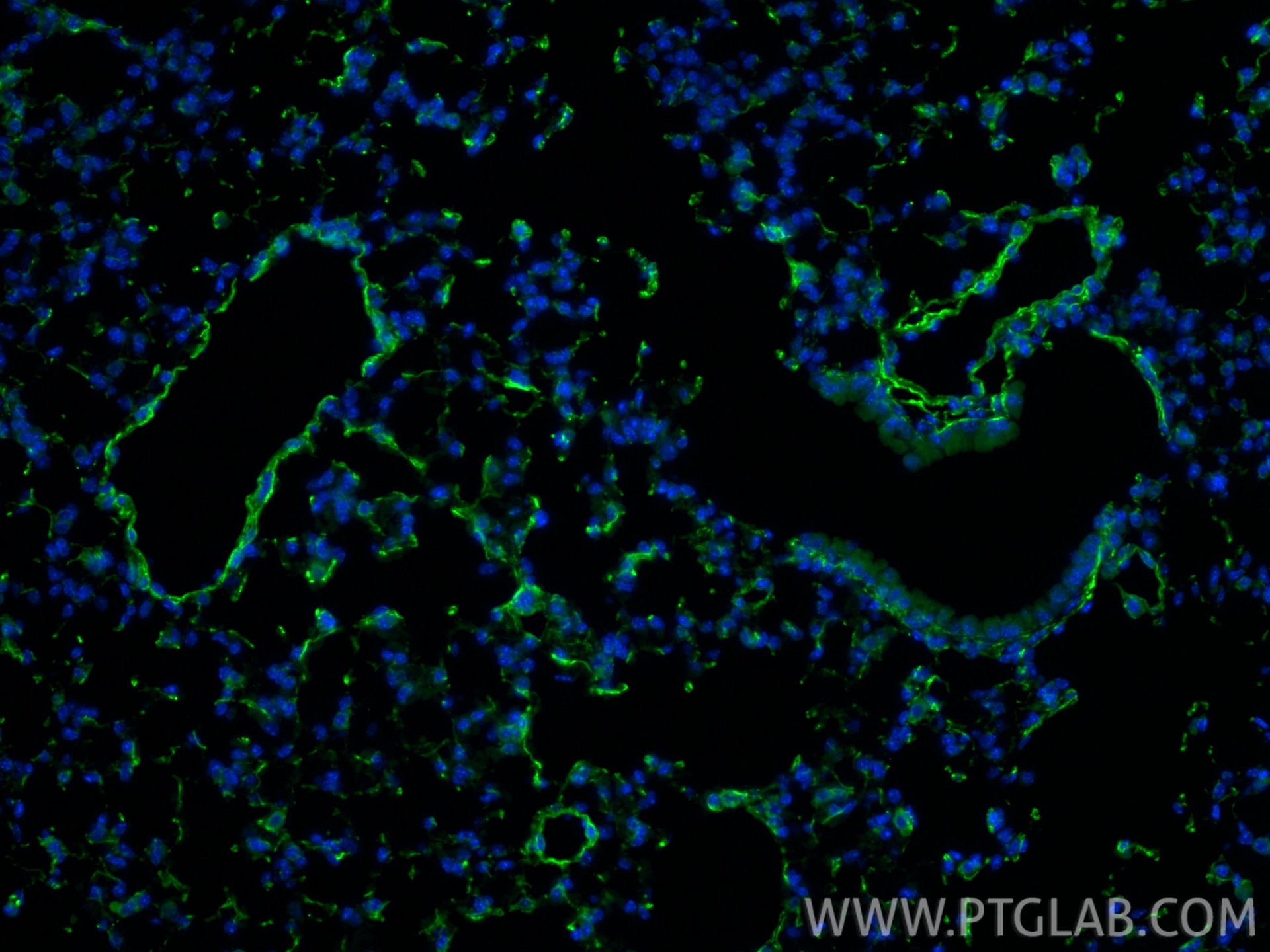 IF Staining of mouse lung using 17661-1-AP Immunofluorescence (IF) / fluorescent staining of mouse lung tissue using MFAP4 Polyclonal antibody (17661-1-AP)