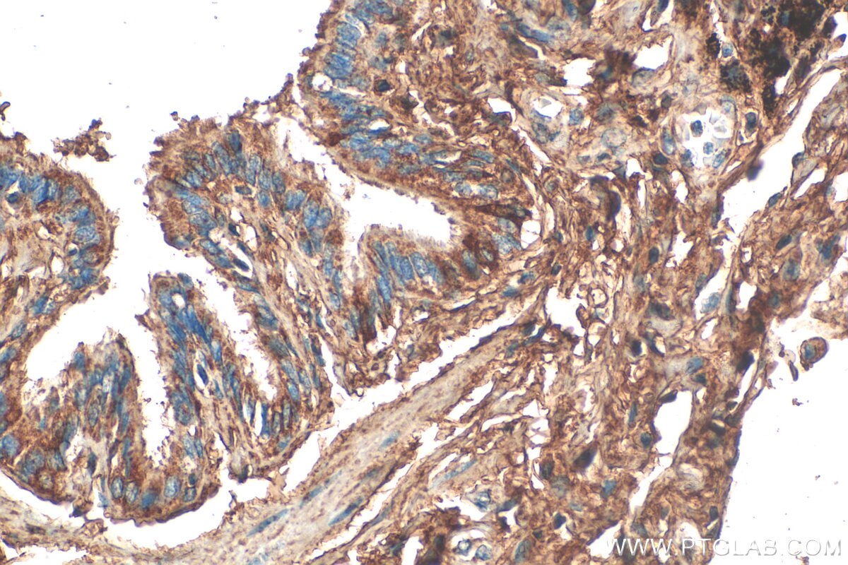 Immunohistochemistry (IHC) staining of human lung tissue using MFAP4 Polyclonal antibody (17661-1-AP)