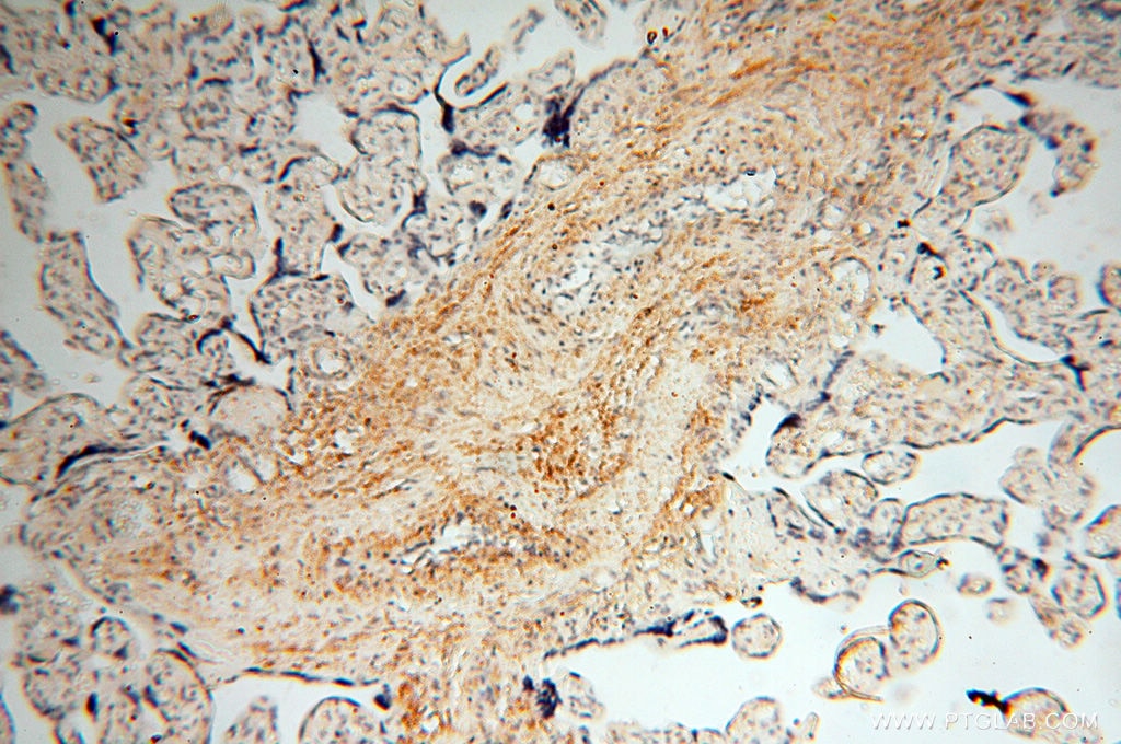 Immunohistochemistry (IHC) staining of human placenta tissue using MFAP4 Polyclonal antibody (17661-1-AP)