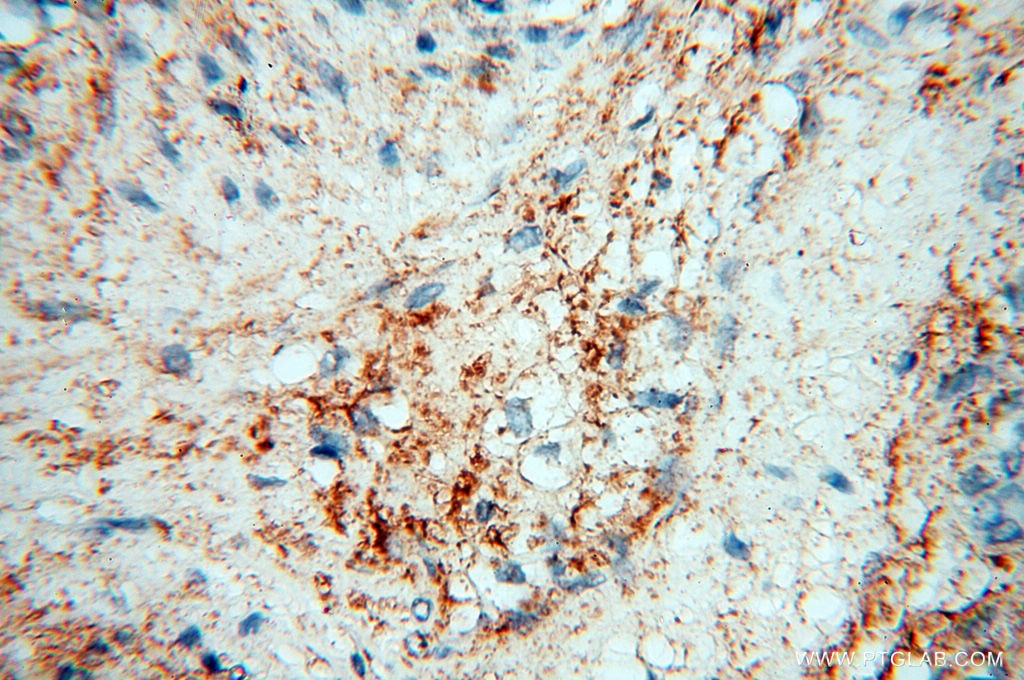 Immunohistochemistry (IHC) staining of human placenta tissue using MFAP4 Polyclonal antibody (17661-1-AP)