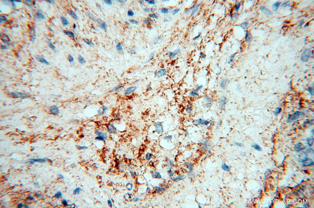 IHC staining of human placenta using 17661-1-AP