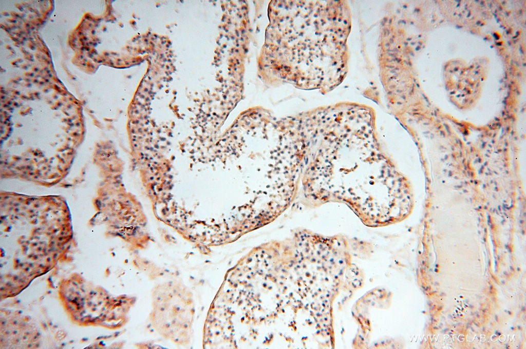 Immunohistochemistry (IHC) staining of human testis tissue using MFAP4 Polyclonal antibody (17661-1-AP)