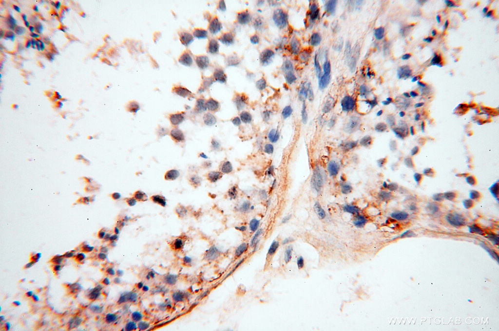 Immunohistochemistry (IHC) staining of human testis tissue using MFAP4 Polyclonal antibody (17661-1-AP)