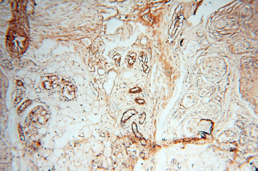 Immunohistochemistry (IHC) staining of human skin tissue using MFAP4 Polyclonal antibody (17661-1-AP)