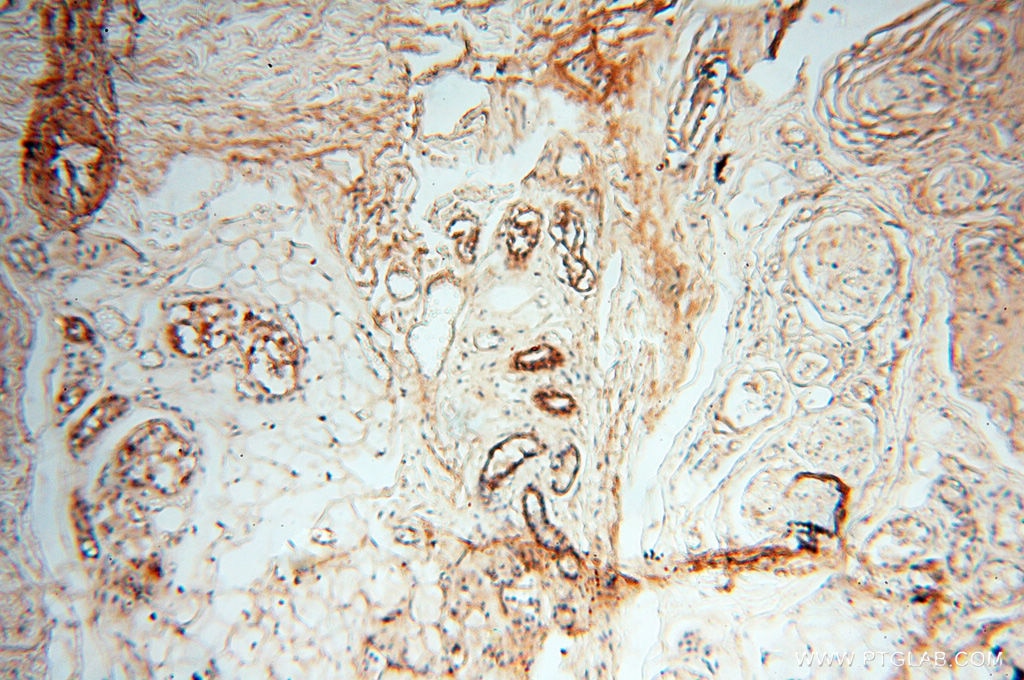 IHC staining of human skin using 17661-1-AP