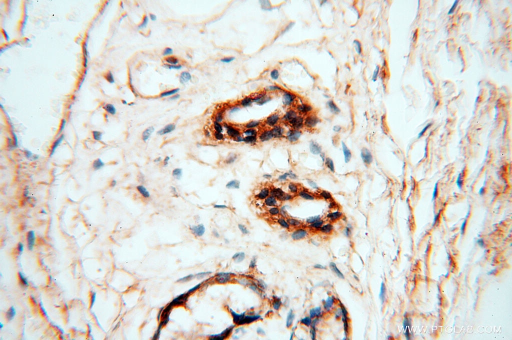 Immunohistochemistry (IHC) staining of human skin tissue using MFAP4 Polyclonal antibody (17661-1-AP)