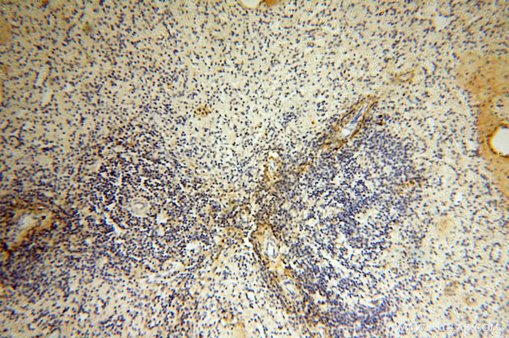 Immunohistochemistry (IHC) staining of human spleen tissue using MFAP4 Polyclonal antibody (17661-1-AP)