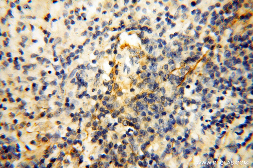 Immunohistochemistry (IHC) staining of human spleen tissue using MFAP4 Polyclonal antibody (17661-1-AP)