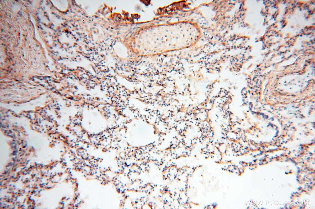 IHC staining of human lung using 17661-1-AP