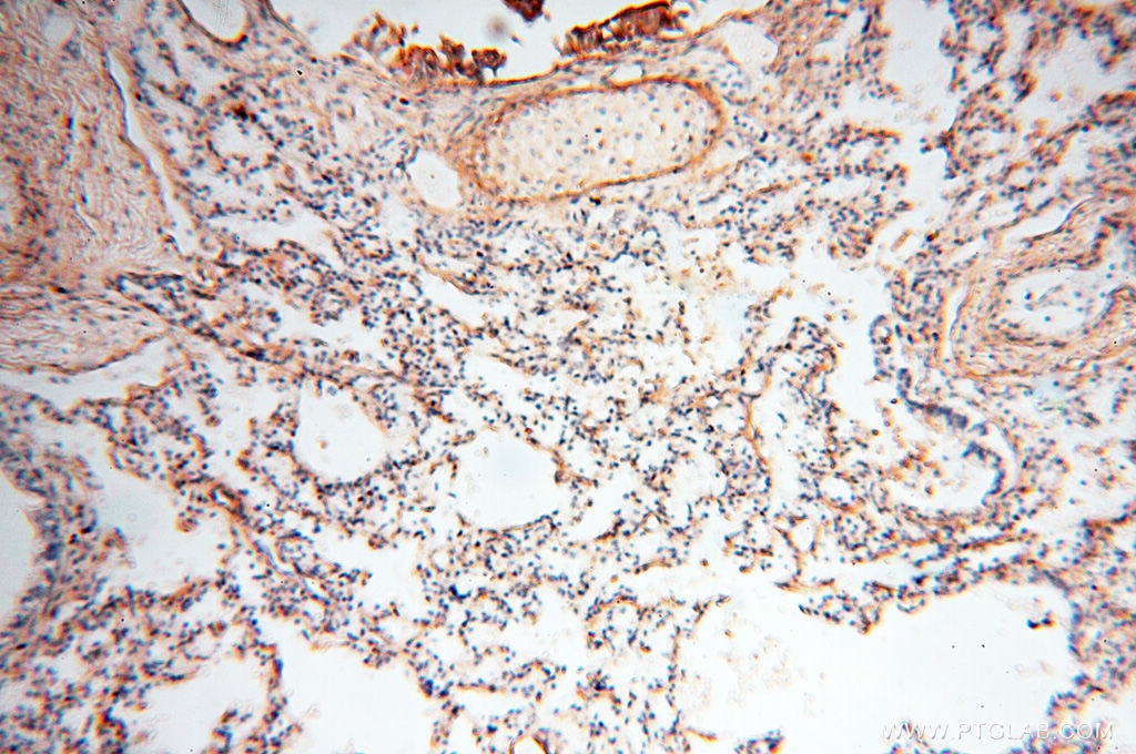 Immunohistochemistry (IHC) staining of human lung tissue using MFAP4 Polyclonal antibody (17661-1-AP)