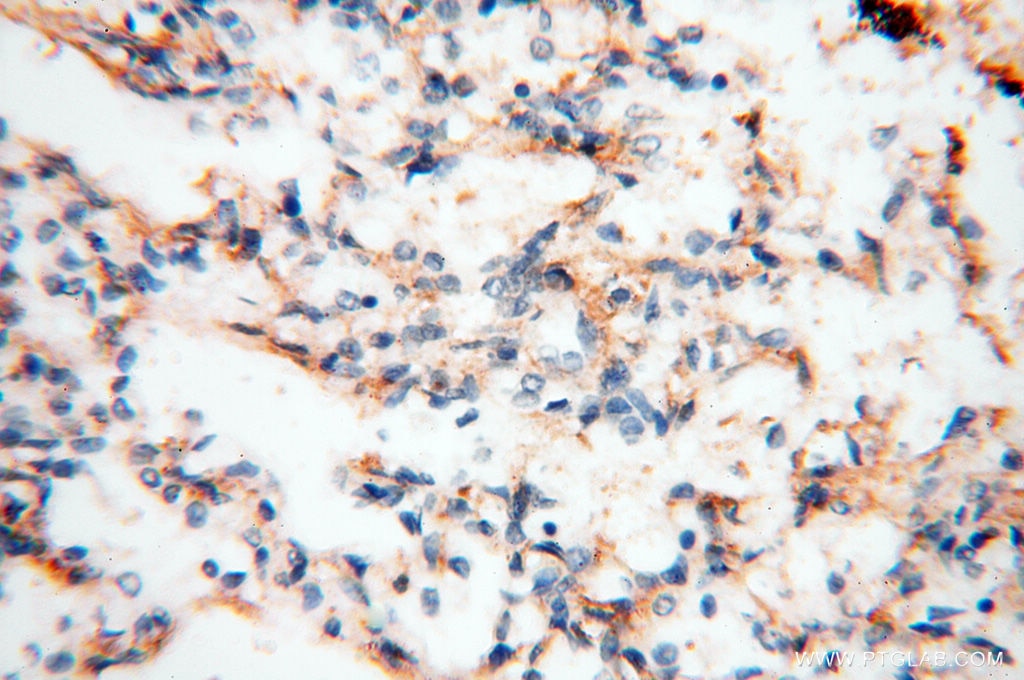 Immunohistochemistry (IHC) staining of human lung tissue using MFAP4 Polyclonal antibody (17661-1-AP)