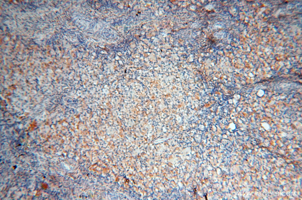 Immunohistochemistry (IHC) staining of human ovary tissue using MFAP4 Polyclonal antibody (17661-1-AP)