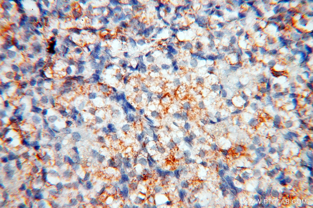 Immunohistochemistry (IHC) staining of human ovary tissue using MFAP4 Polyclonal antibody (17661-1-AP)