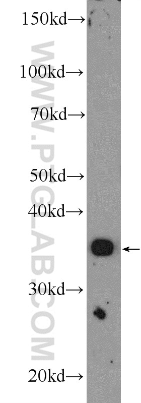 Western Blot (WB) analysis of rat lung tissue using MFAP4 Polyclonal antibody (17661-1-AP)