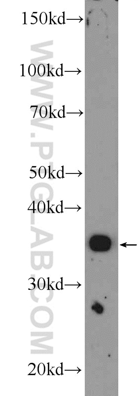 WB analysis of rat lung using 17661-1-AP